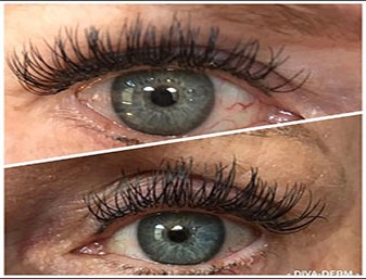 EYELINER TATTOOING