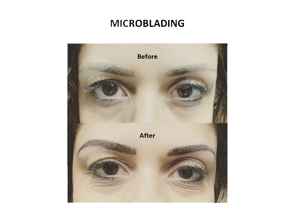 microblading