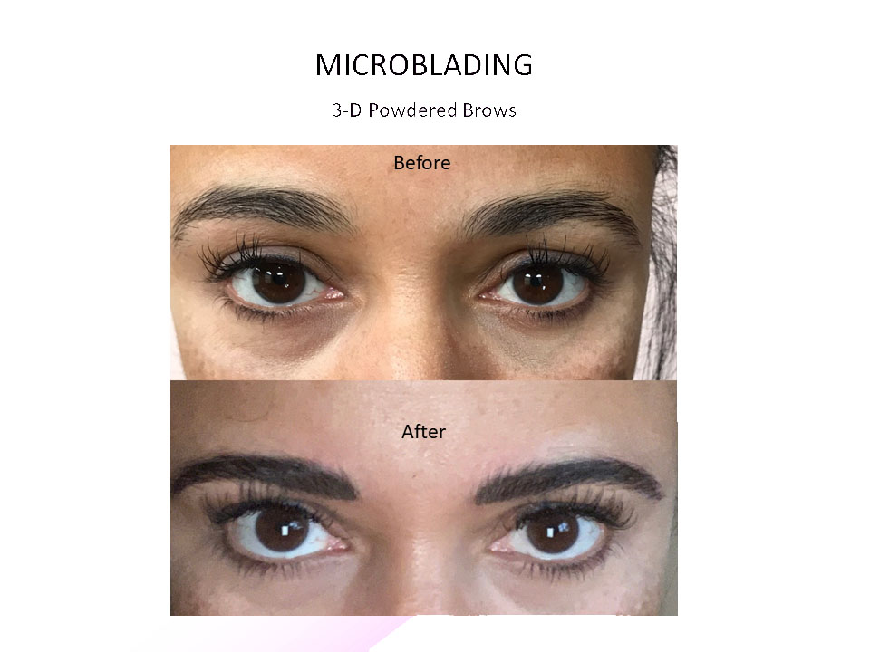 microblading