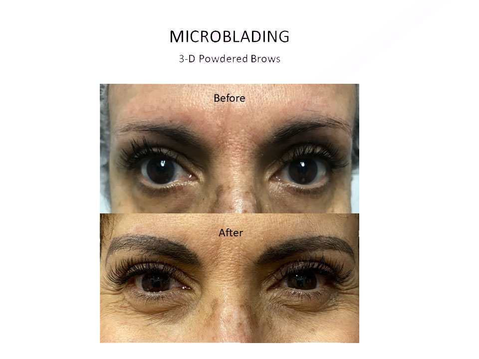 microblading