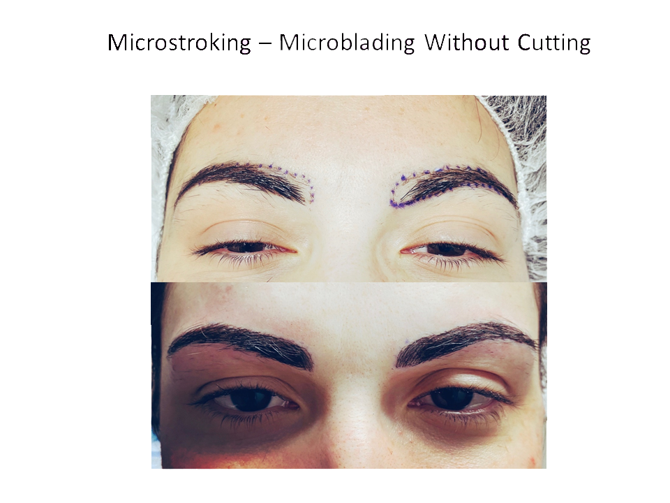 microstroking