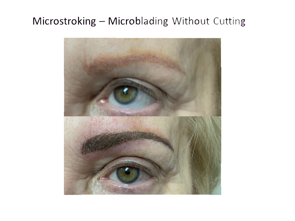 microstroking