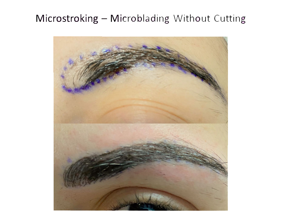 microstroking