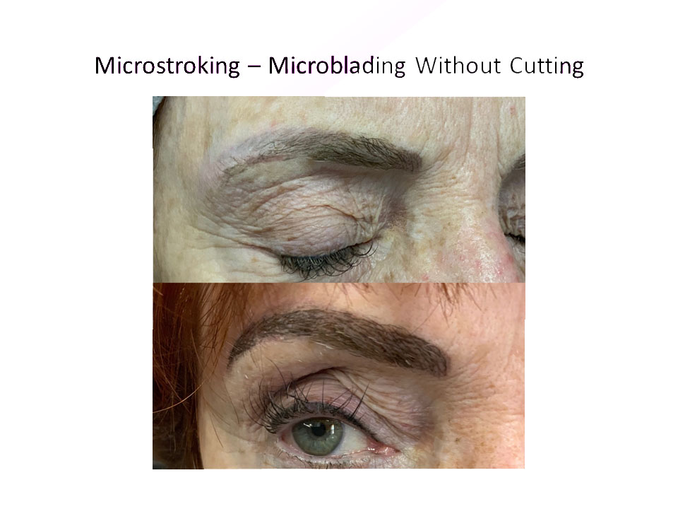 microstroking