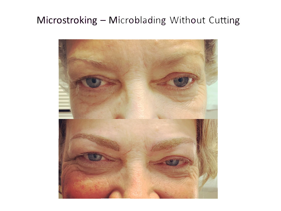 microstroking