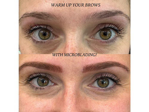 brows